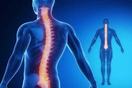 قهوه گانودرما برای دیسک کمر