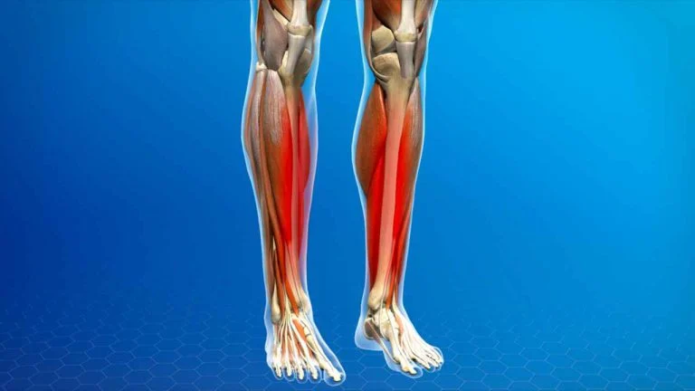 علت درد ماهیچه پشت ساق پا در کودکان و بزرگسالان چیست؟