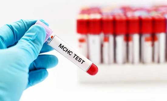 mchc در آزمایش خون چیست؟ تفسیر بالا و پایین بودن m.c.h.c 