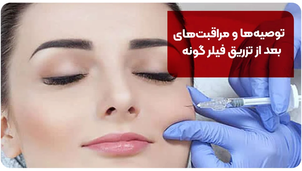 توصیه&zwnj;ها و مراقبت&zwnj;های بعد از تزریق فیلر گونه